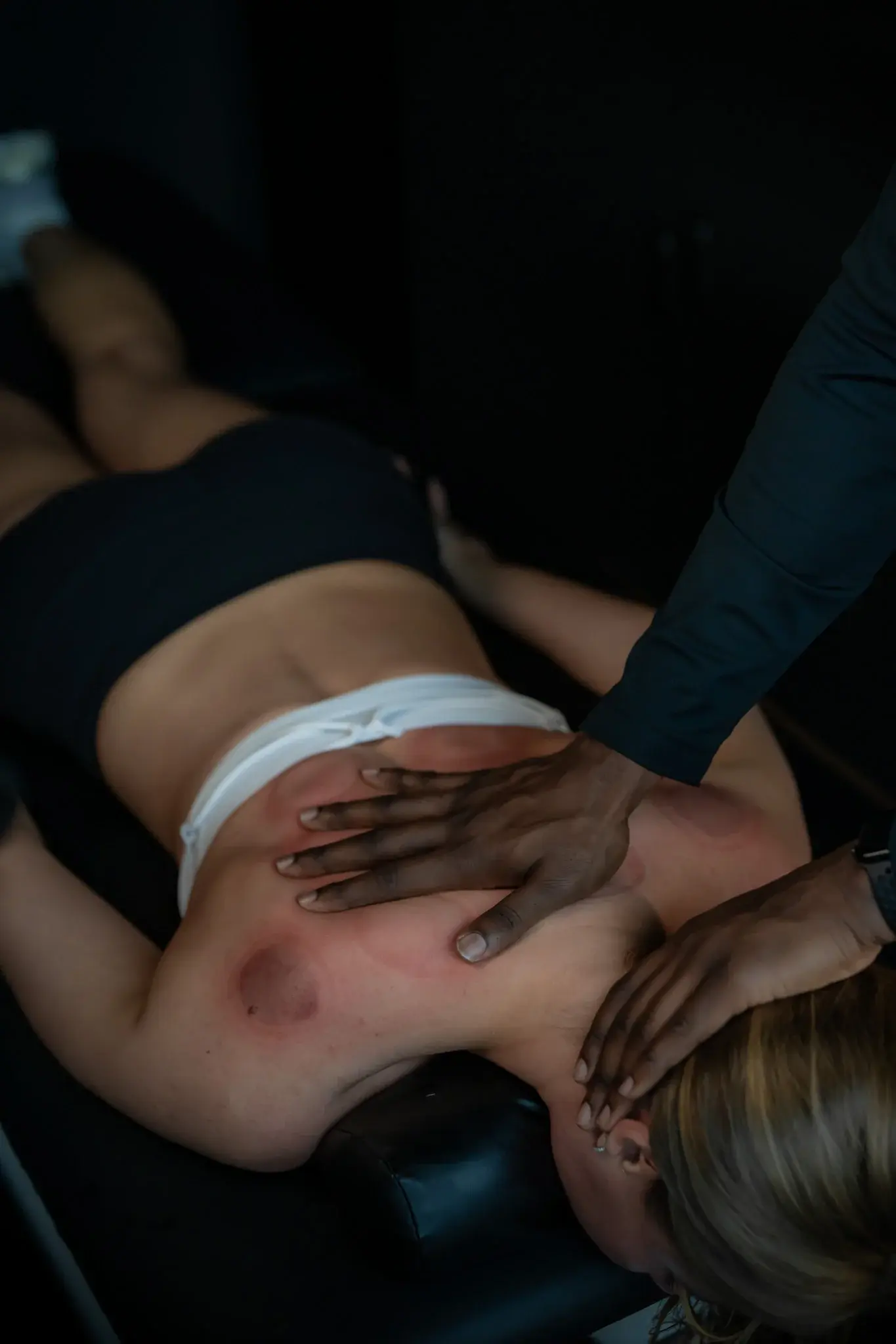 Manual therapy and soft tissue work on the back after cupping at PROS